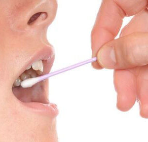 procedimiento-04 boca23